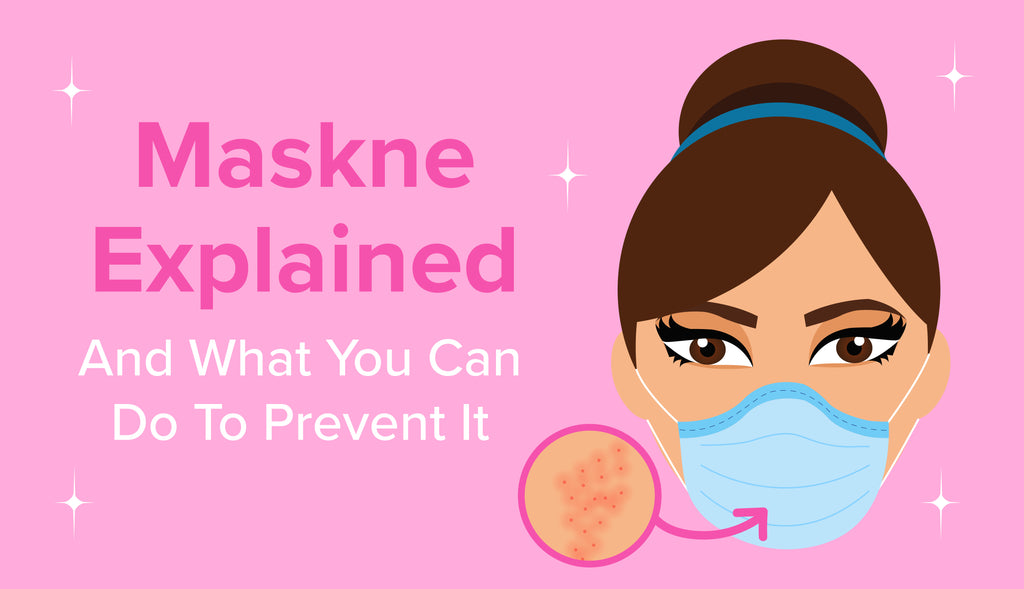Maskne Explained and What You Can do to Prevent it