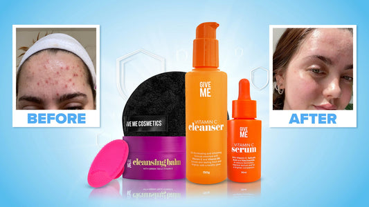 Fight your acne today! - Give Me Cosmetics