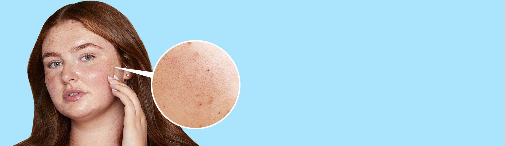 Products For Acne- Prone Skin | Give Me Cosmetics
